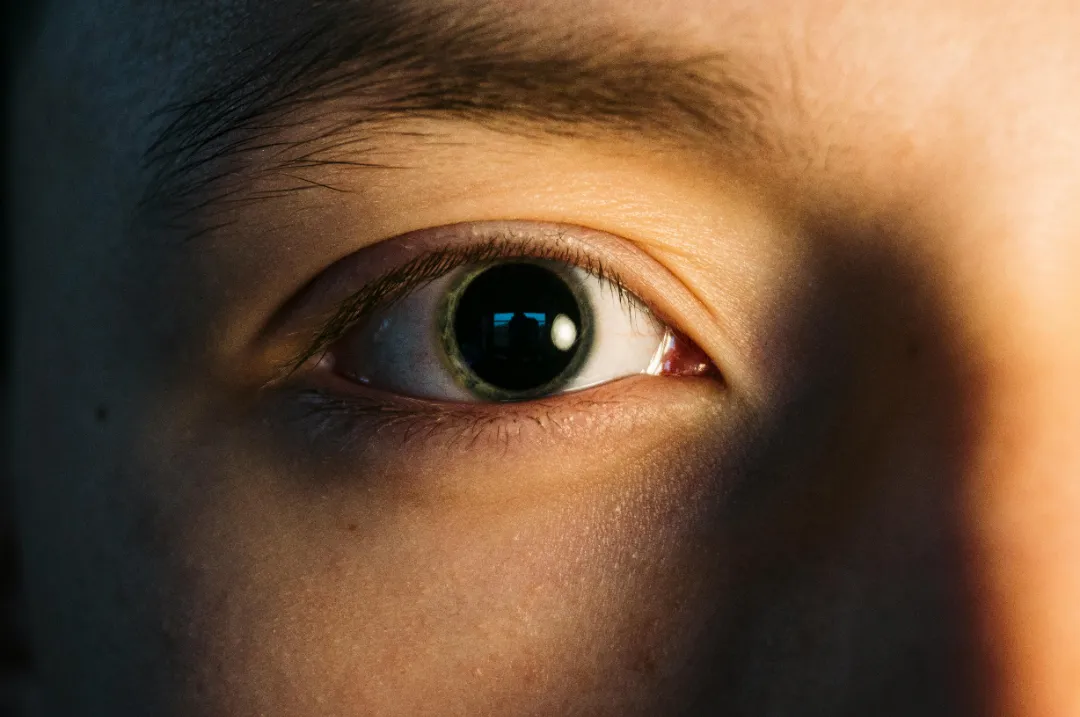廈門眼科中心引入個體化定制眼眶假體，助力眼眶骨折患者“精準重建”！