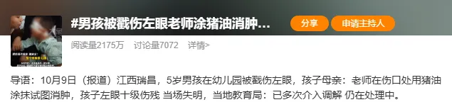 眼外傷